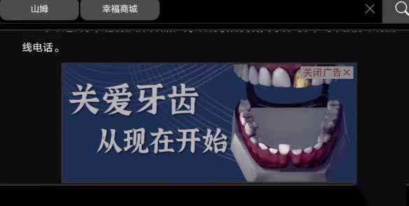 《黑暗筆錄》金牙獲取方法